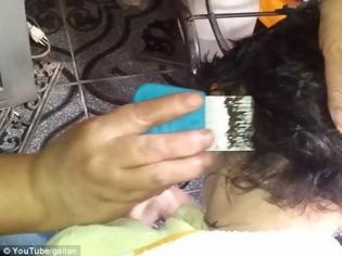 Φωτογραφία για ΤΡΟΜΑΚΤΙΚΟ: Δείτε πόσες ψείρες έχει αυτό το κοριτσάκι στο κεφάλι της [video]