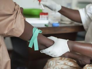 Φωτογραφία για Ο πρόεδρος χώρας (!) που υποστήριζε πως θεραπεύει φορείς του AIDS «σκοτώνει» δεκάδες