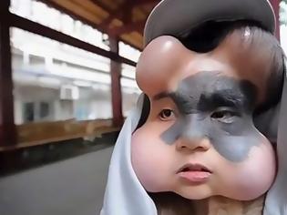 Φωτογραφία για Γυναίκα ζει με 4 μπαλόνια στο πρόσωπό της  - Ο λόγος που έβαλε τα εμφυτεύματα είναι συγκλονιστικος