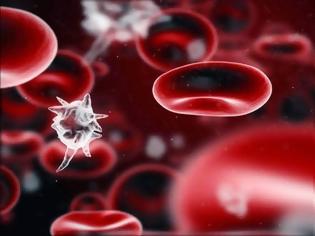 Φωτογραφία για Χαμηλά αιμοπετάλια (θρομβοπενία) και αυξημένα αιμοπετάλια (θρομβοκυττάρωση). Που οφείλονται οι διαταραχές των αιμοπεταλίων