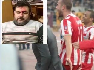 Φωτογραφία για Αγρια επίθεση σε οπαδό της ΑΕΚ - Είχε κάνει μήνυση σε προπονητή και παίκτη του Ολυμπιακού