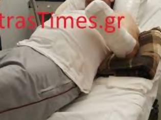 Φωτογραφία για Πάτρα: Χειροβομβίδα κρότου λάμψης ακρωτηριασε τον υπάλληλο του Δήμου στην Ξερόλακκα