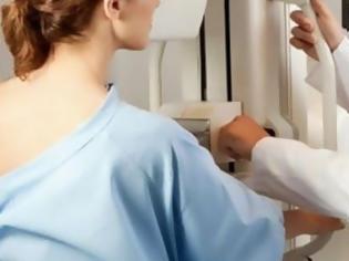 Φωτογραφία για Ψηλαφητά ογκίδια στο μαστό σε νεαρές γυναίκες: Τι είναι;