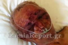 Οργή και φόβος για την έκρηξη της εγκληματικότητας - Δολοφονίες, ληστείες και βασανισμοί σε ολόκληρη τη χώρα
