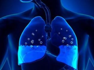 Φωτογραφία για Πνευμονικό οίδημα: Τα σημάδια που δείχνουν συσσώρευση υγρού στον πνεύμονα!