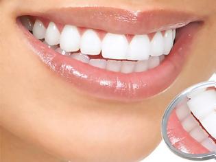 Φωτογραφία για Λεύκανση δοντιών στο σπίτι: 10 εύκολα tips!