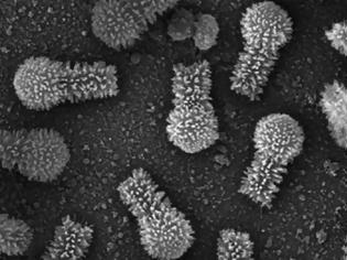Φωτογραφία για Ανακαλύφθηκαν δύο σπάνιοι γιγάντιοι ιοί με τα περισσότερα γονίδια για δημιουργία πρωτεϊνών