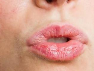 Φωτογραφία για 7 τρόποι να απαλλαγείτε από τα σκασμένα χείλη