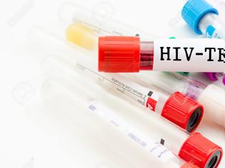 Φωτογραφία για Το rapid test είναι εξαιρετικά σημαντικό για την έγκαιρη ανίχνευση του HIV