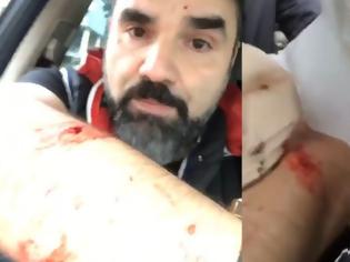 Φωτογραφία για Επίθεση στον δημοσιογράφο Νάσο Γουμενίδη: Οι δράστες τον χτυπούσαν με σφυρί! Video