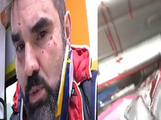 Φωτογραφία για ΣΟΚ: Επίθεση με βαριοπούλες δέχτηκε ο δημοσιογράφος Νάσος Γουμενίδης - Συγκλονίζει το βίντεο που ανέβασε λίγα δευτερόλεπτα μετά [video]