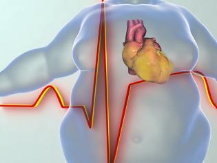 Φωτογραφία για Περιττά κιλά: Πόσο αυξάνουν τον κίνδυνο θανάτου από καρδιαγγειακά αίτια