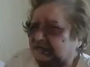 Φωτογραφία για Σοκ στη Σαλαμίνα! Ληστές «σακάτεψαν» στο ξύλο 83χρονη για να της πάρουν τη σύνταξη [Βίντεο]