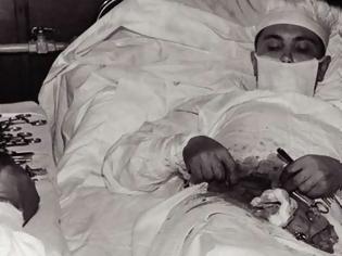 Φωτογραφία για Μπράβο για τη δύναμη της ψυχής σου: Ο σοβιετικός γιατρός που αναγκάστηκε να χειρουργήσει μόνος του τον εαυτό του [photos+video]