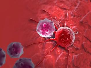 Φωτογραφία για Για ποιο λόγο αναπτύσσονται καρκινικοί όγκοι στο σώμα μας;