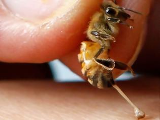 Φωτογραφία για Τσίμπημα από μέλισσα ή σφήκα: Τι συμβαίνει στο σώμα και πώς το χειριζόμαστε