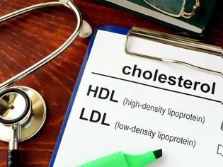 Φωτογραφία για Η σημασία της καλής, HDL, χοληστερόλης στο ανοσοποιητικό σύστημα
