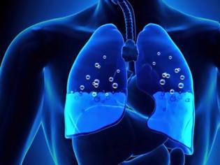 Φωτογραφία για Ποια συμπτώματα μπορούν να υποδηλώνουν ότι υπάρχει συσσώρευση υγρού στον πνεύμονα;