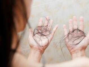 Φωτογραφία για Απώλεια μαλλιών στη γυναίκα: Πού οφείλεται και πώς αντιμετωπίζεται