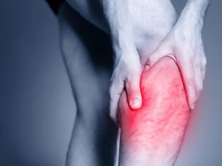 Φωτογραφία για Θρόμβος στο πόδι: Για ποιους καρκίνους αυξάνει τον κίνδυνο