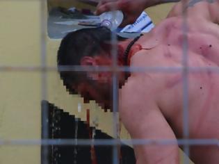 Φωτογραφία για Αιματηρά επεισόδια σε αγώνα μπαράζ της Γ’ Εθνικής