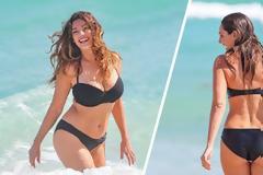 Βήμα – βήμα πώς θα εξαφανίσεις την κυτταρίτιδα και τις ραγάδες!