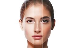 Δυσχρωμίες στο δέρμα: ο φυσικός τρόπος για να τις αντιμετωπίσεις!