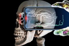 Καρκίνος από τα κινητά τηλέφωνα: Τι έδειξε νέα έρευνα -σοκ