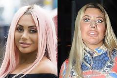 Ίου! Την πάτησε άσχημα η τηλεστάρ: H πλαστική της κατέστρεψε το πρόσωπο