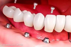 Έτσι γίνονται τα θαύματα: 10 παράξενες θεραπείες ομορφιάς που χρησιμοποιούν οι διάσημοι στο Χόλιγουντ