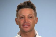 Το τερμάτισε: Είναι εθισμένος στις πλαστικές και κοντεύει να μοιάζει με κούλα σήμερα - Δεν του έφταναν τα ψεύτικα οπίσθια και τώρα...