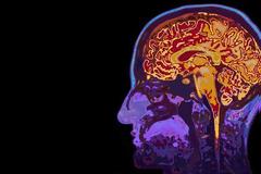 Έντονη Διαμαρτυρία της ΠΟΑμΣΚΠ για το ΦΕΚ 1560/8.5.2018