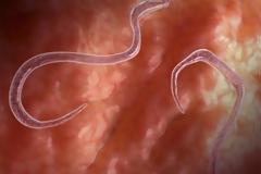 Προσοχή: Τα σημάδια που δείχνουν ότι μπορεί έχετε παράσιτα στο έντερο