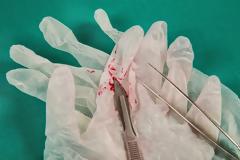 Κoριτσάκι υπέφερε από πονόλαιμο και οι γιατροί έπαθαν αμόκ με αυτό που βρήκαν στο λαιμό της... [photo]