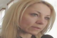 Αντί για ενέσεις μπότοξ της έκανε ενέσεις με δηλητήριο οχιάς - Δείτε τι έπαθε... [photos]