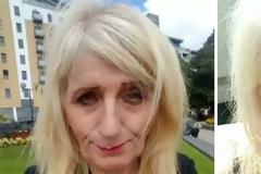 Τον Δεκέμβριο κέρδισε 4 εκατομμύρια στο Λαχείο. Δείτε πως έγινε μετά από 2 μήνες πλαστικών και θα σοκαριστείτε [photos]