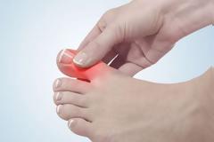 Ποια συμπτώματα δείχνουν ότι είναι ανεβασμένο το ουρικό οξύ; Ποιες οι φυσιολογικές τιμές του;