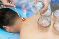 Βεντούζες με ποτήρια: Τι ισχύει πραγματικά για το παλιό γιατροσόφι