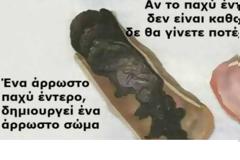 ΣΗΜΑΝΤΙΚΟ: Το έντερο μπορεί να περιέχει μέχρι και 9 κιλά τοξίνες δηλητηριάζοντας τον οργανισμό σας - Δείτε πως θα το καθαρίσετε