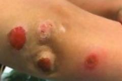 Ο Γιος της γύρισε από ένα παιδικό πάρτι με αυτά τα περίεργα σημάδια. Όταν έμαθε τι ήταν, έπαθε ΣΟΚ...