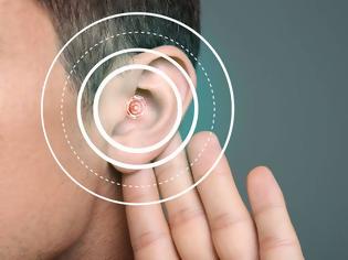 Φωτογραφία για Απώλεια ακοής σε νεαρή ηλικία: Ποιοι οι κίνδυνοι για τον εγκέφαλο