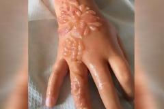 7χρονη γύρισε από τις διακοπές της σημαδεμένη για όλη της τη ζωή - Σοκαρισμένοι οι γονείς δεν μπορούσαν να πιστέψουν πως… [photos]