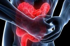 Ποια θρεπτικά συστατικά έχει ανάγκη ο οργανισμός σας αν πάσχετε από ελκώδη κολίτιδα;