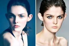 Πως θα απαλλαγώ από τα πεταχτά αυτάκια;