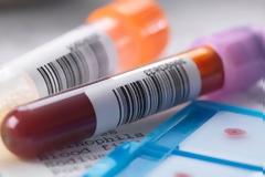 Ποιες αιτίες οδηγούν στην αύξηση των ηπατικών ενζύμων;