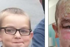 Δύσκολες ώρες για 7χρονο αγόρι. Το τραγικό λάθος, που τον σημάδεψε για μια ζωή [photos]