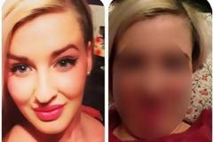 Δεν θα πιστεύετε πως έγινε αυτή η κοπέλα μετά από... [photo]