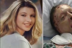 Άντρας έκαψε ζωντανή την 33χρονη σύντροφο του κι εκείνη κατέθεσε εναντίον του στο δικαστήριο από τον «τάφο» της