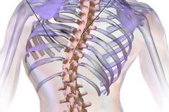 ΣΠΑΤΑ, ΑΡΤΕΜΙΣ-ΕΞΕΛΙΞΕΙΣ!!! Δεν χρειάζεται πια 600€ θα μπορέσει να σηκωθεί!