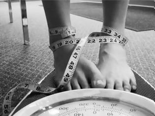 Φωτογραφία για Διατροφικές διαταραχές: Ποια σημάδια θα μας ανησυχήσουν;